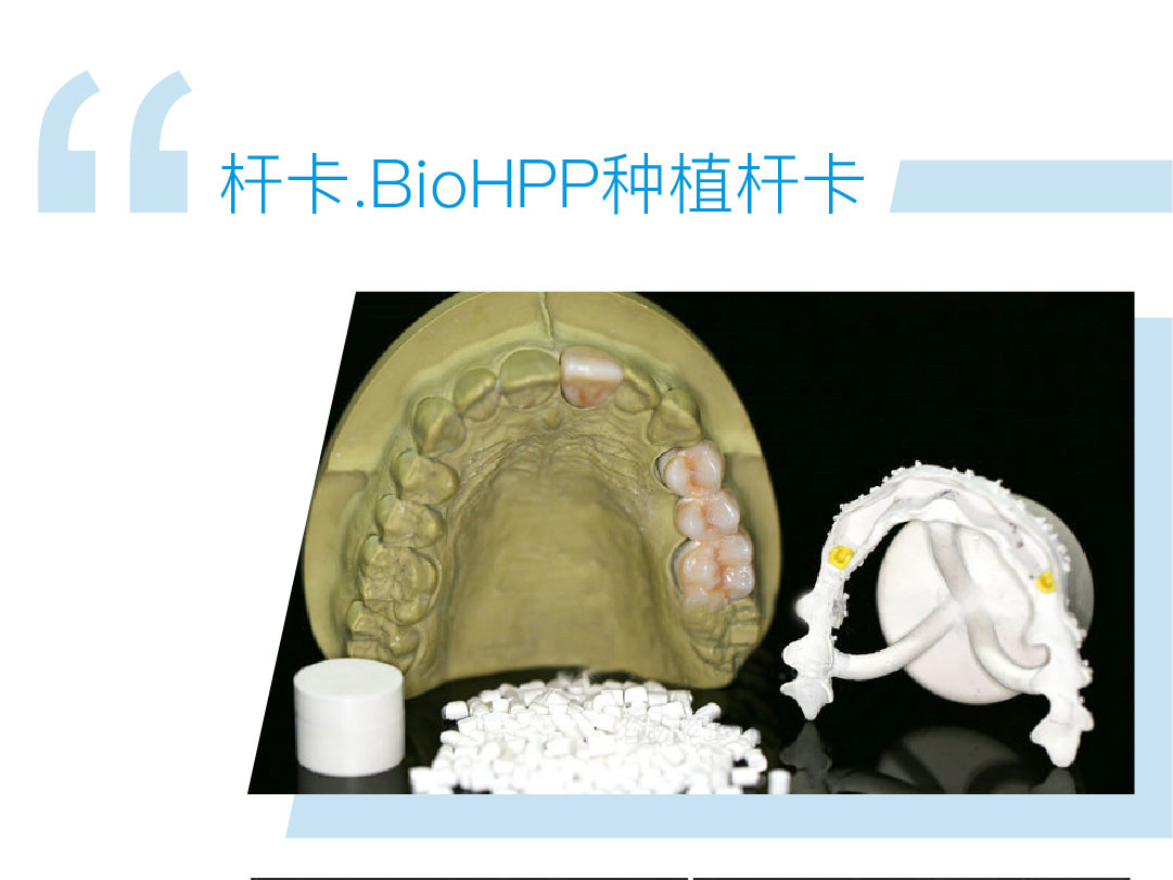 BIO-HPP种植杆卡