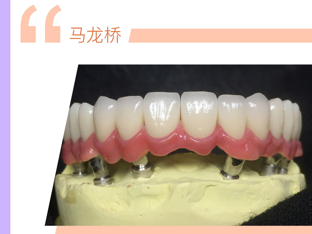 马龙桥