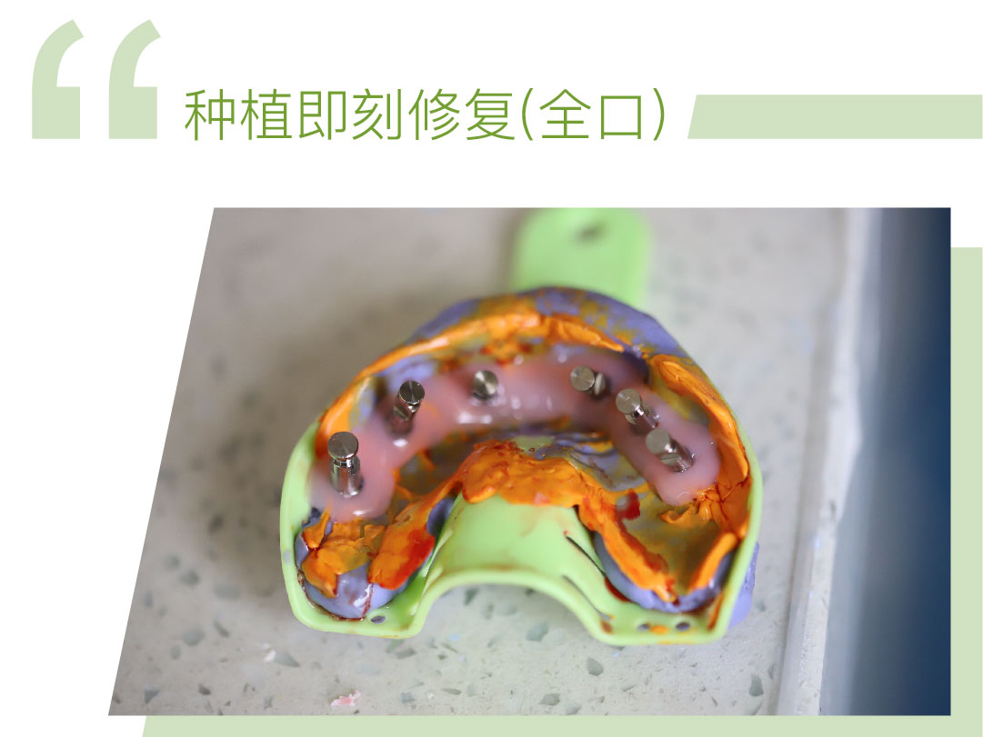 种植即刻修复