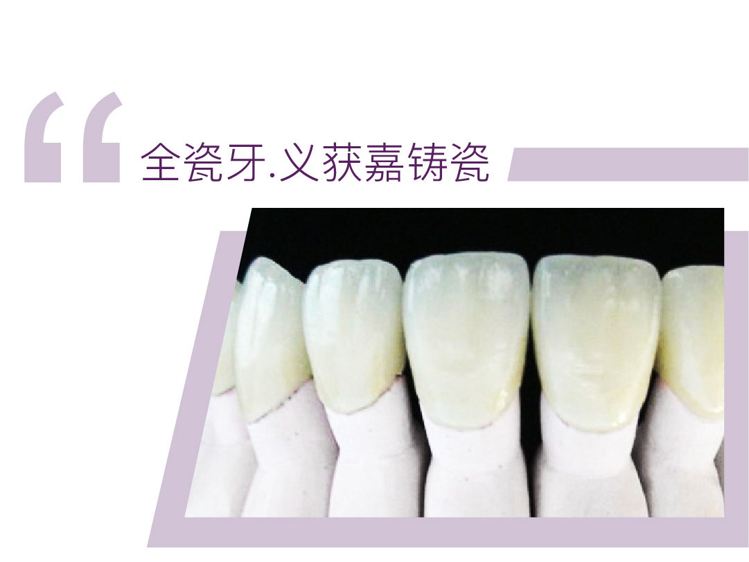义获嘉铸瓷全瓷牙