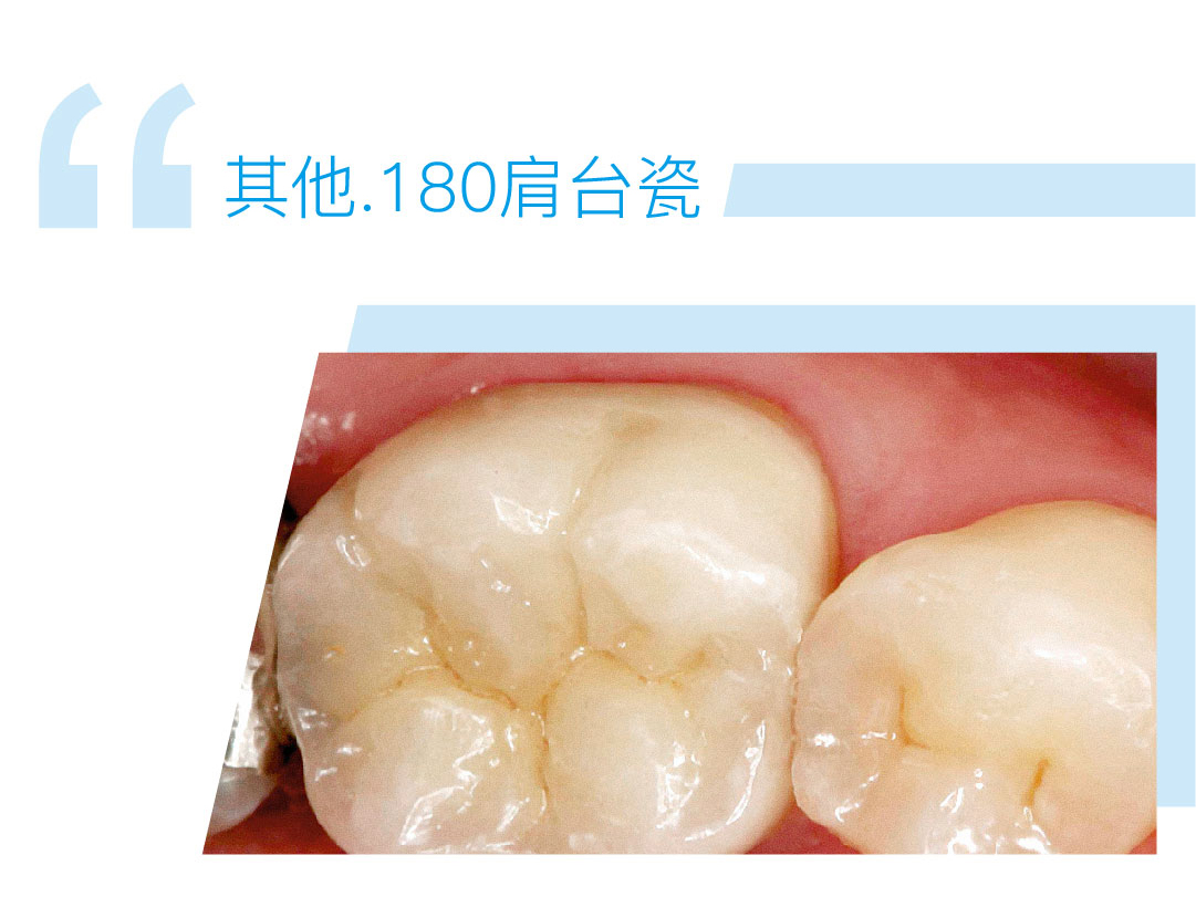 180肩台瓷