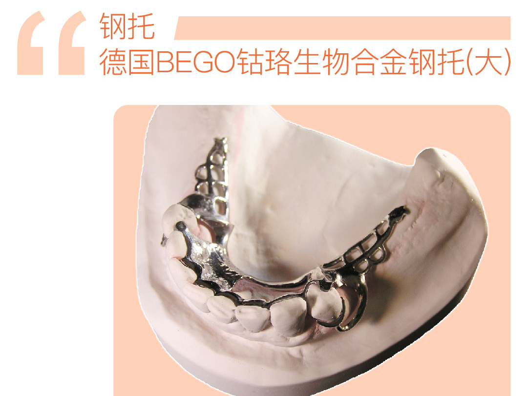 德国BEGO钴铬生物合金钢托