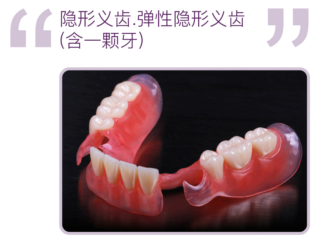 弹性隐形义齿