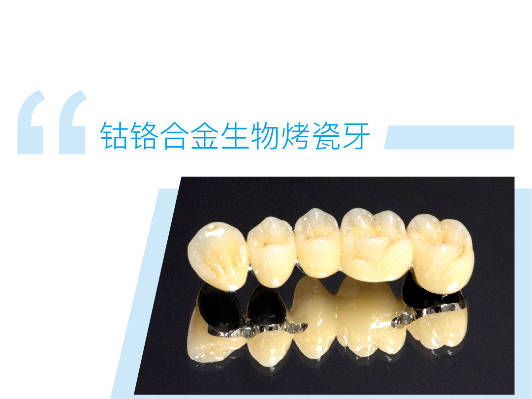 钴铬合金生物烤瓷牙