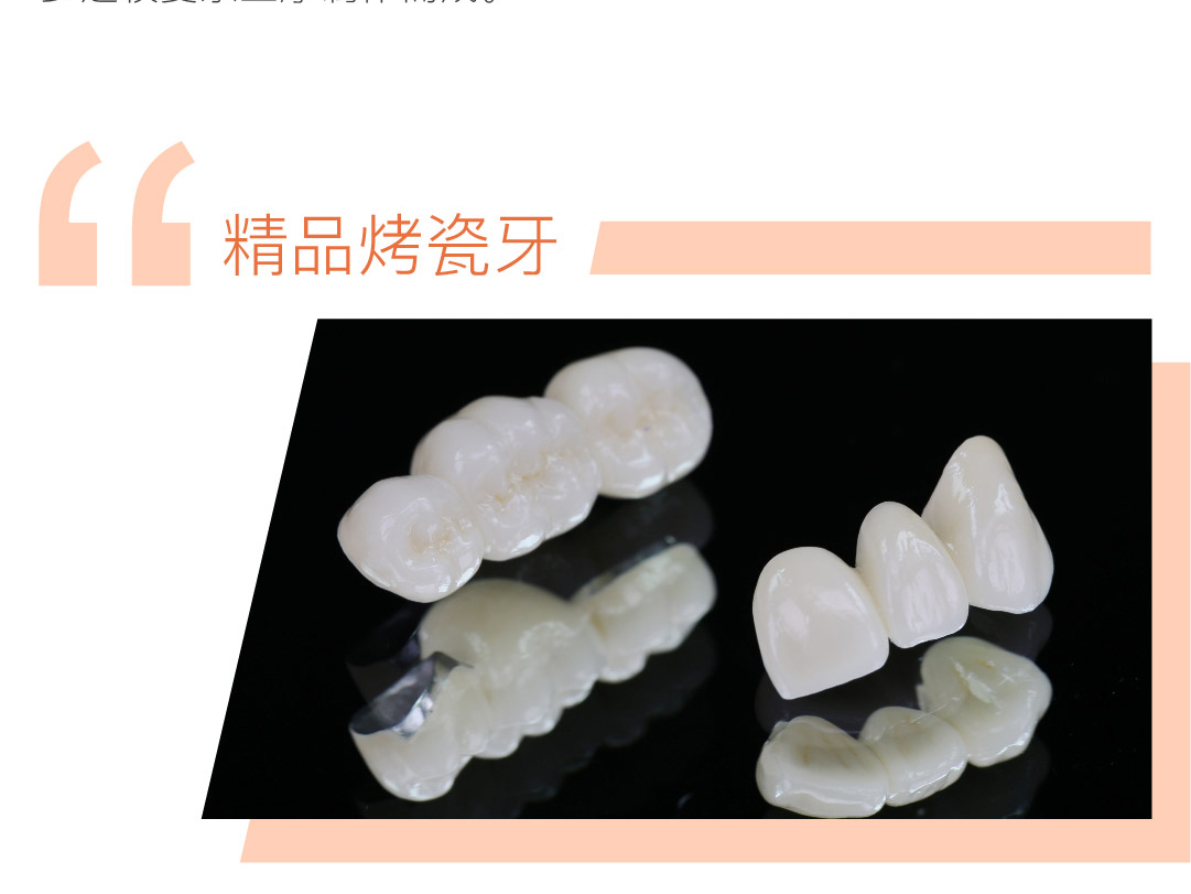 精品烤瓷牙