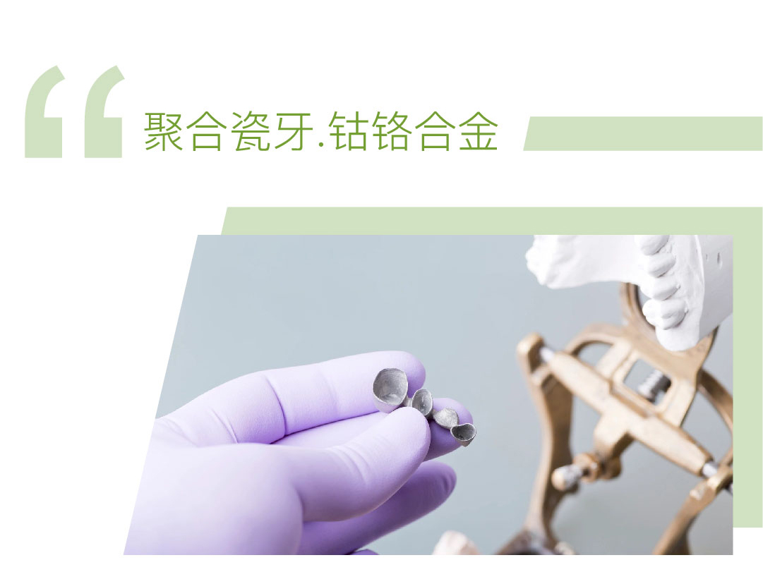 钴铬合金聚合瓷牙