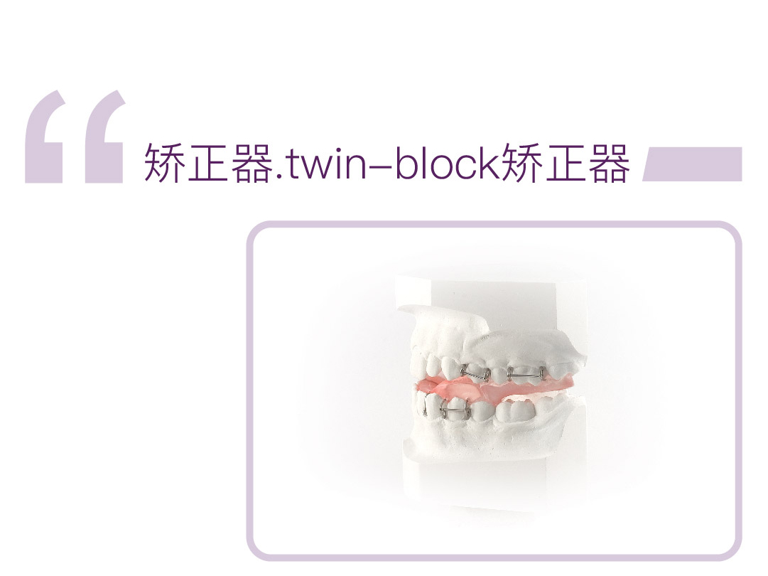 twin-block矫正器（不加扩弓器）