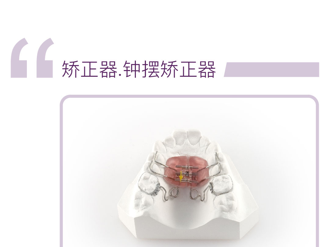 钟摆矫正器