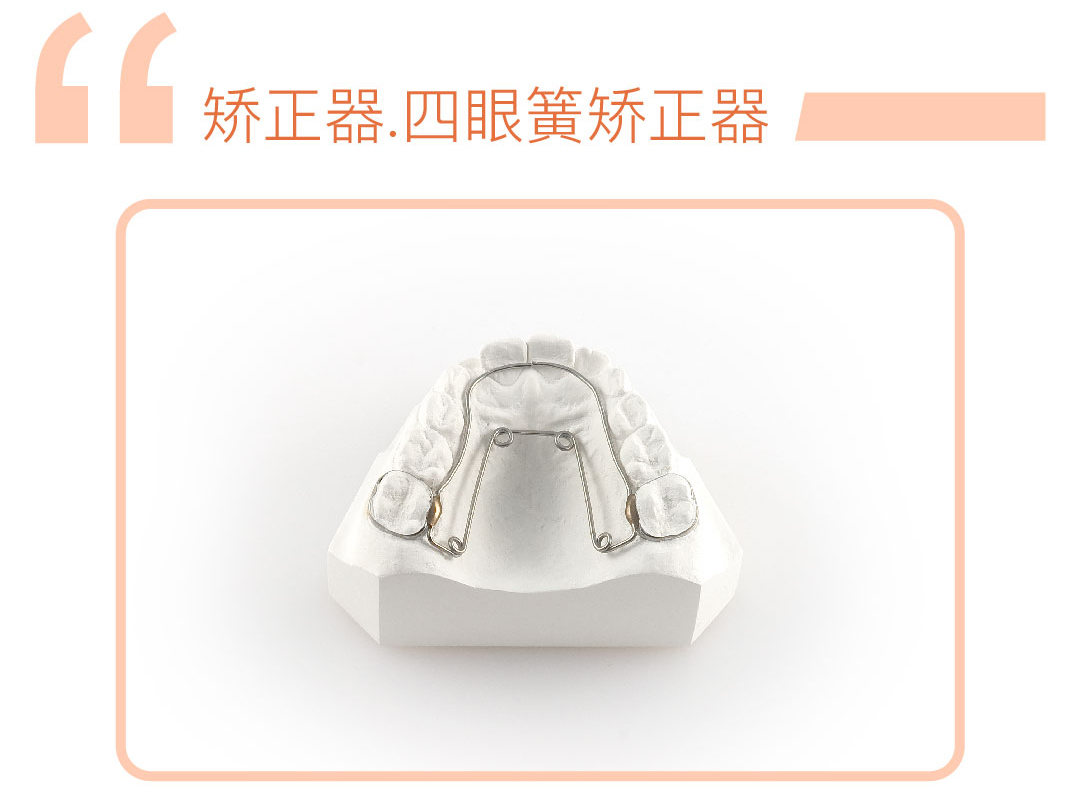 四眼簧矫正器