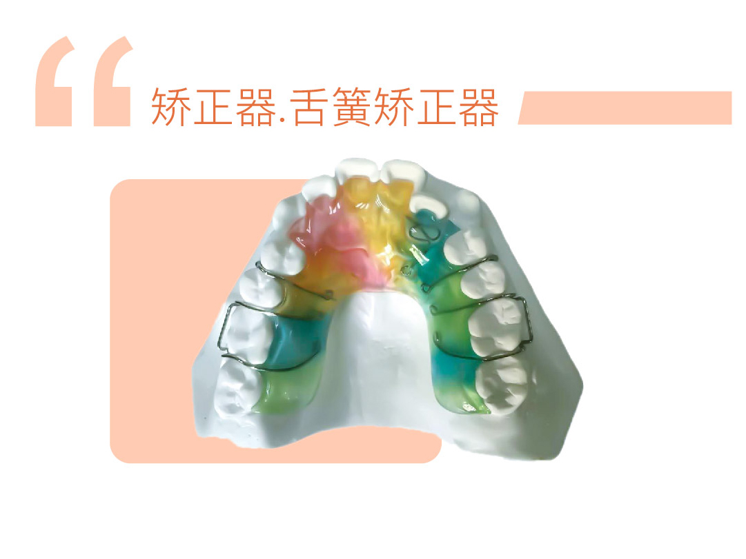 舌簧矫正器