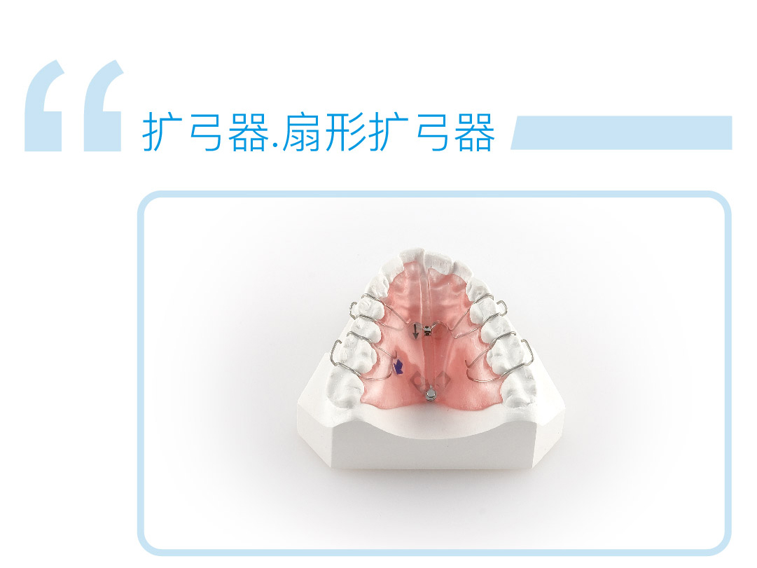 扇形扩弓器