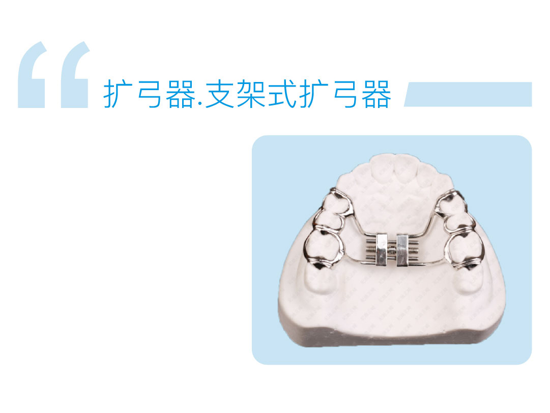 支架式扩弓器