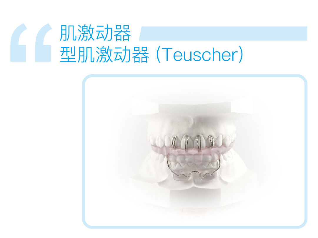 型肌激动器Teuscher