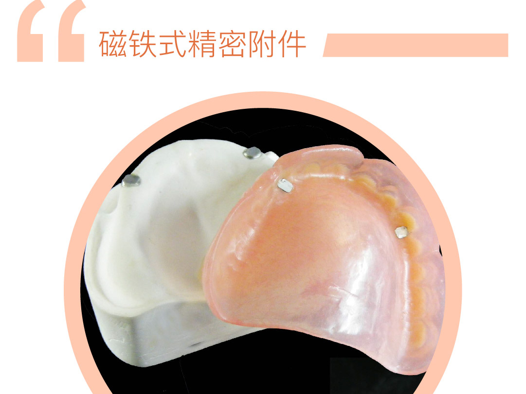 磁铁式精密附件