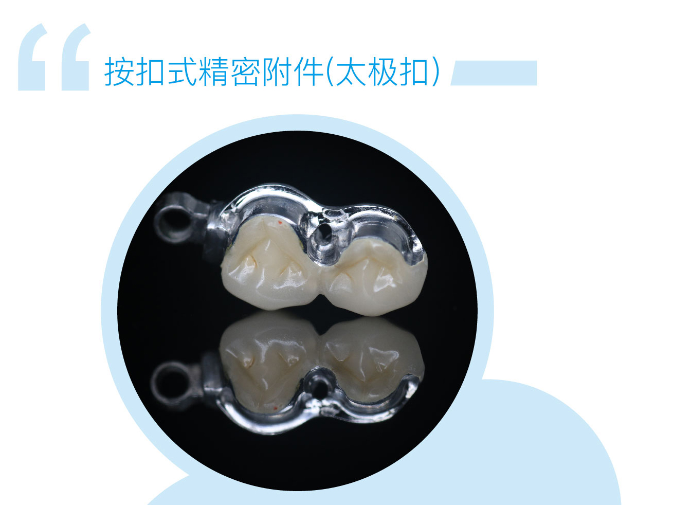 按扣式精密附件(太极扣）