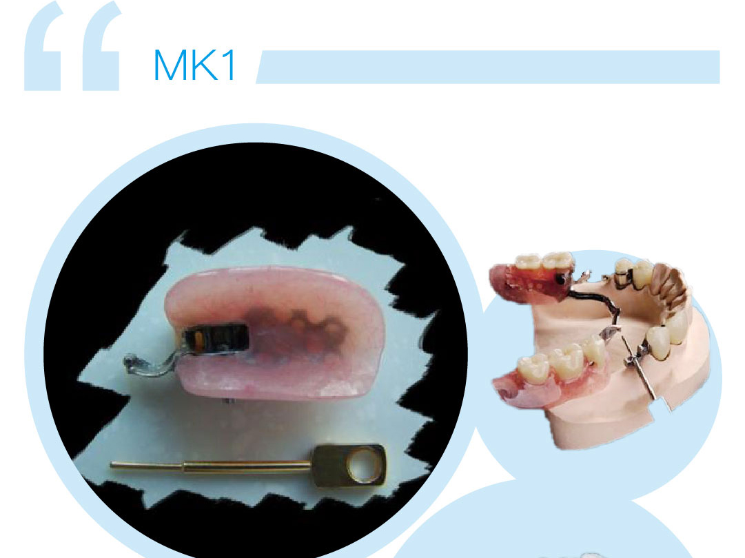 MK－1