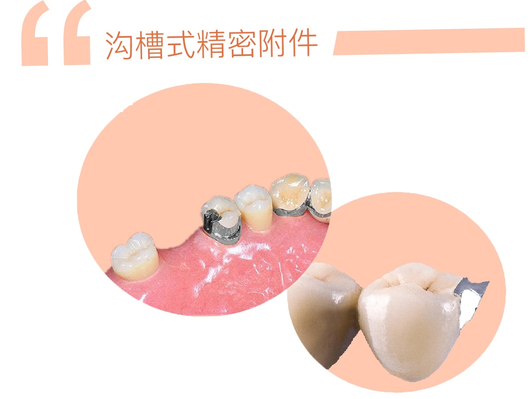 沟槽式精密附件