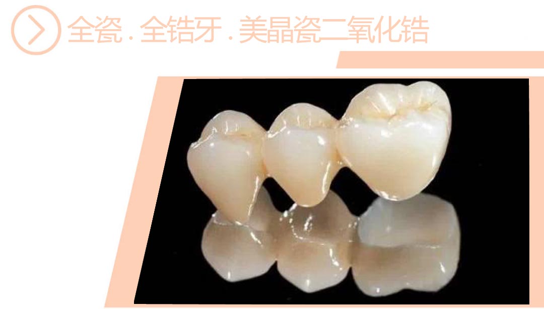 美晶瓷二氧化锆全瓷/全锆牙