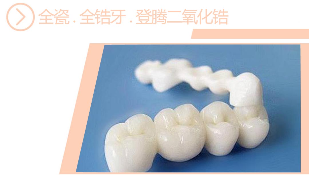 登腾二氧化锆全瓷/全锆牙