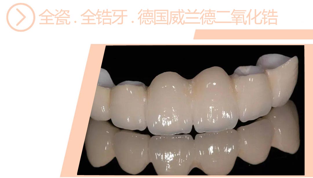 德国威兰德二氧化锆全瓷/全锆牙