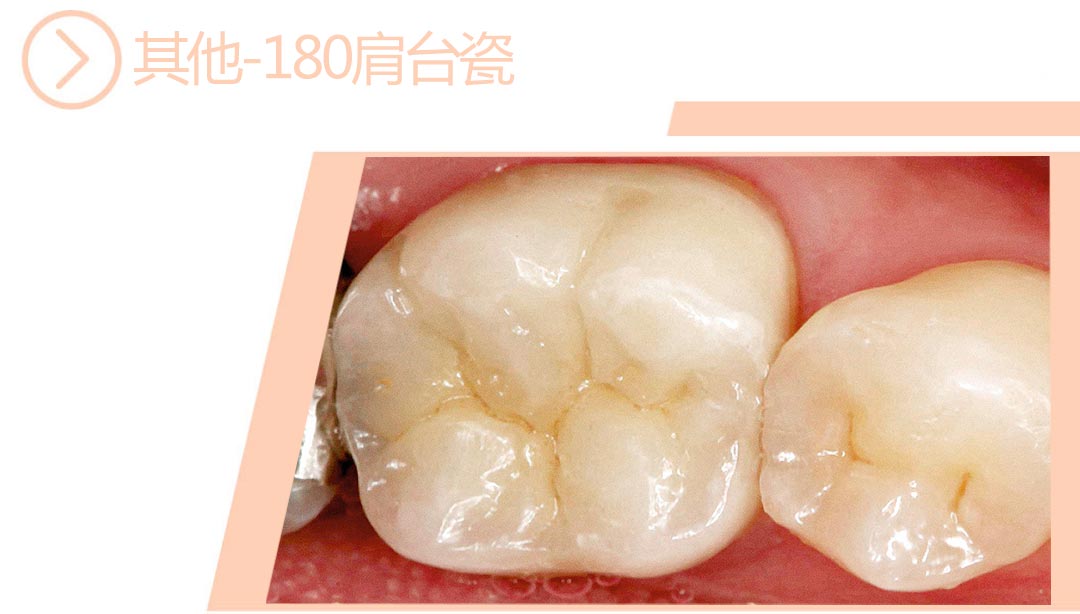 180肩台瓷