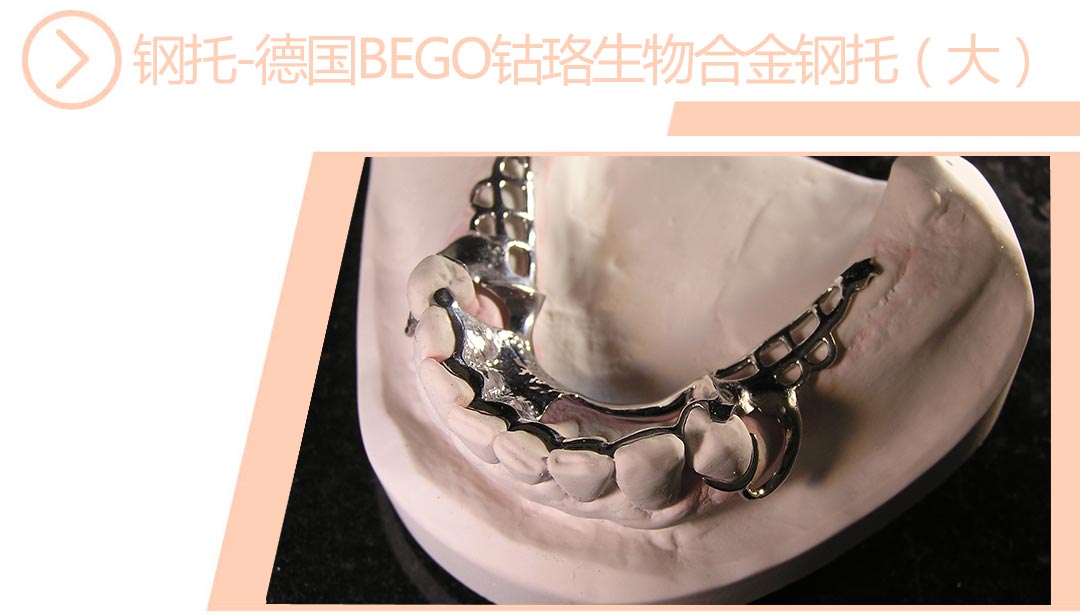德国BEGO钴铬生物合金钢托