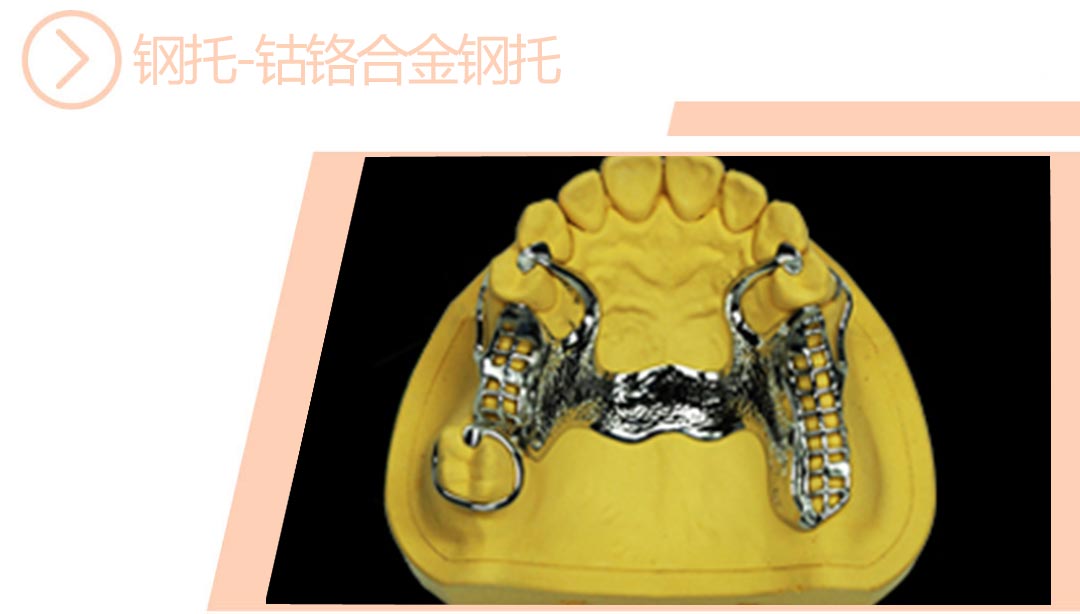钴铬合金钢托
