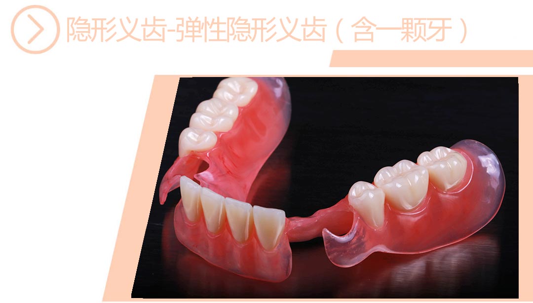 弹性隐形义齿
