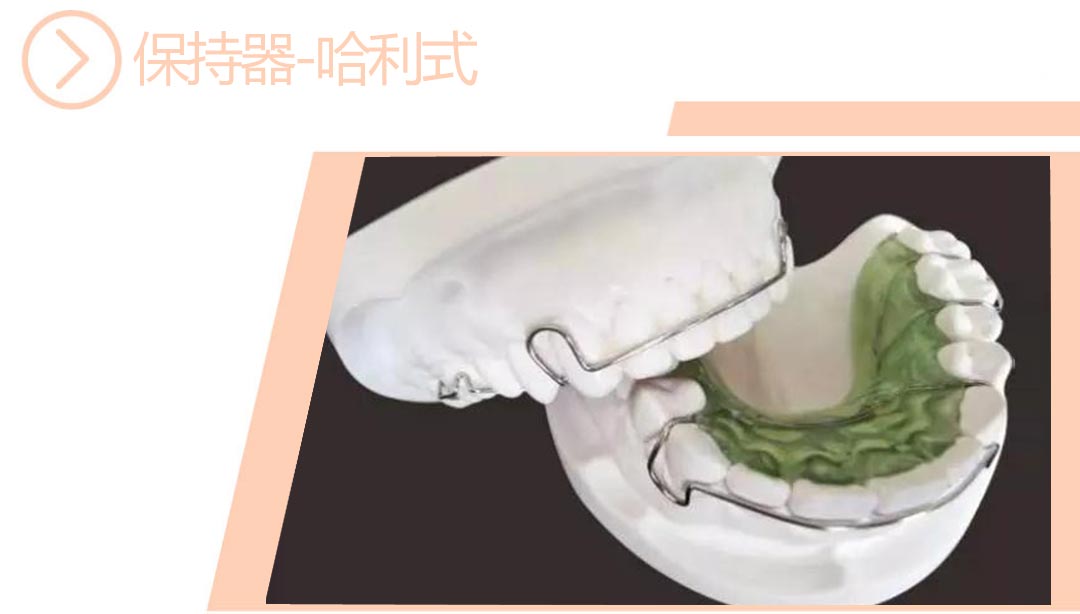 哈利氏保持器（钢丝）