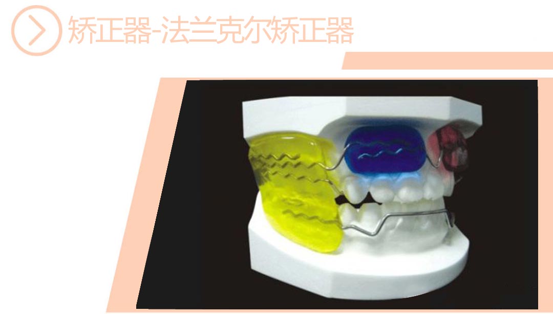 法兰克尔矫正器