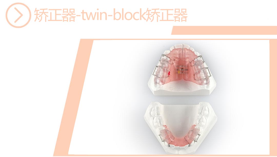twin-block矫正器（不加扩弓器）