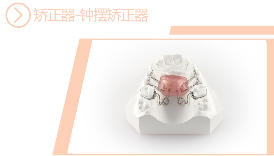钟摆矫正器