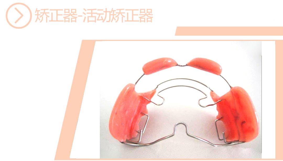 活动矫正器
