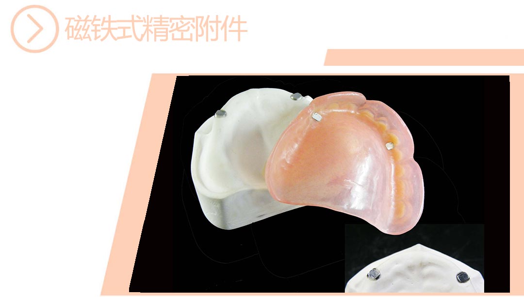磁铁式精密附件