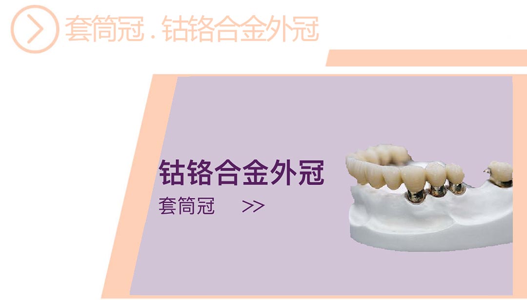 钴铬金属套筒冠