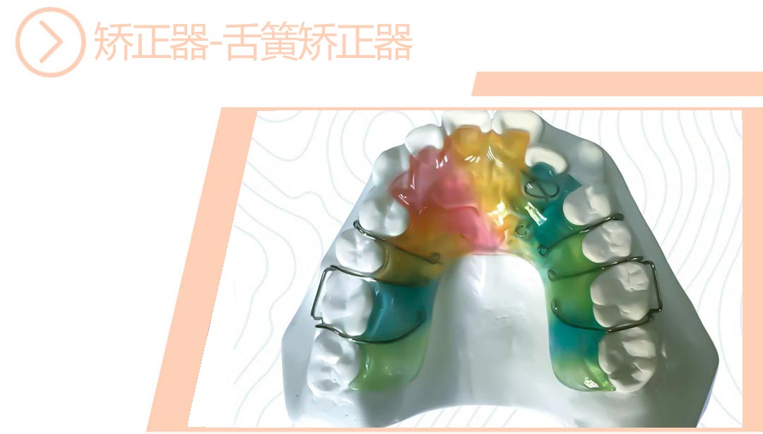 舌簧矫正器