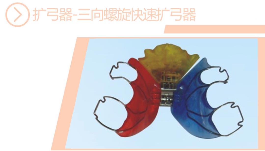 三向螺旋快速扩弓器