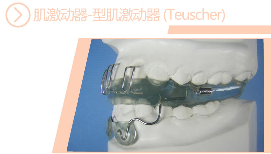 型肌激动器Teuscher