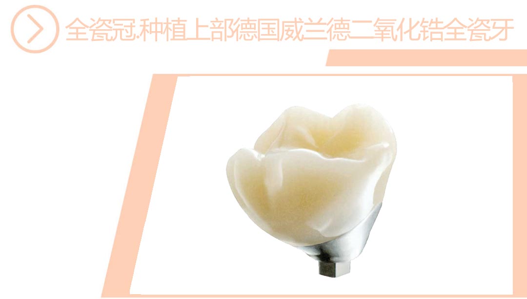 种植上部德国威兰德二氧化锆全瓷牙