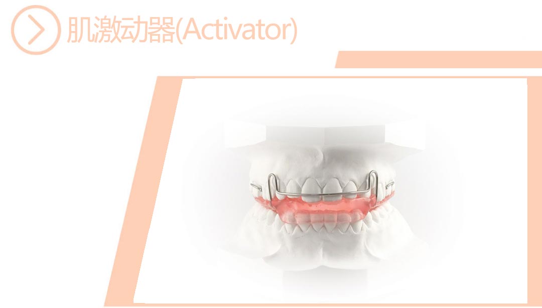 肌激动器(Activator)