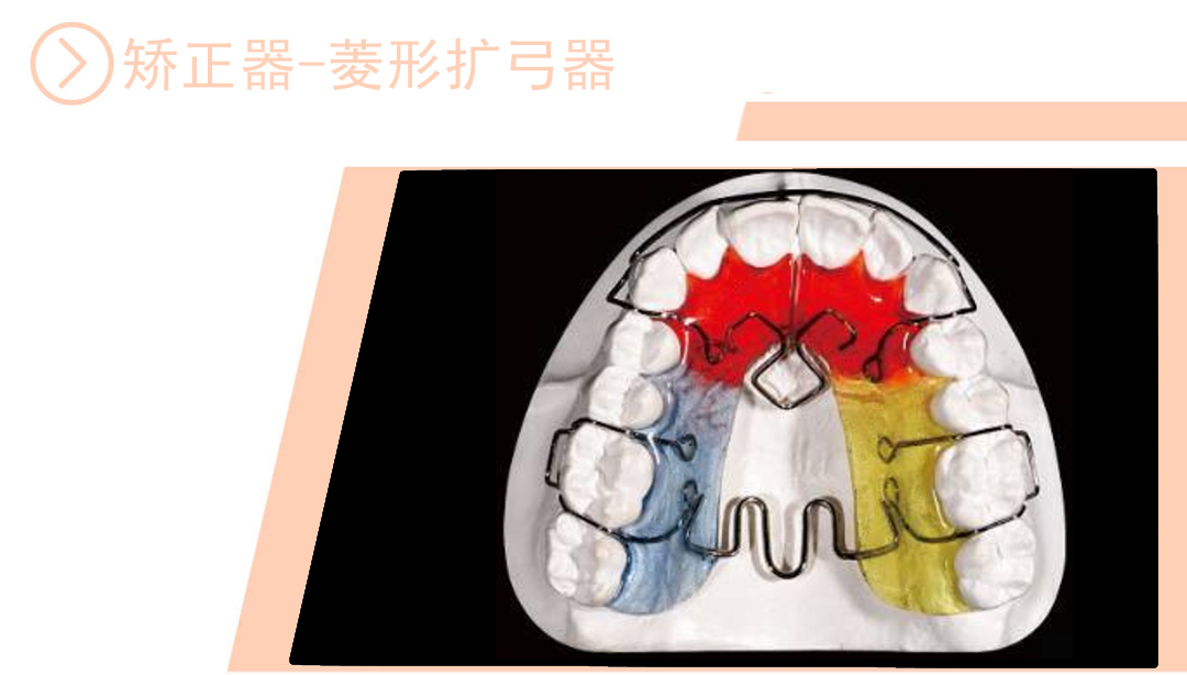 菱行扩弓器